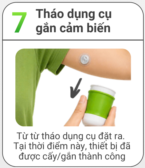 Bước 7: Tháo dụng cụ gắn cảm biến